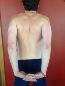 back stretch 1