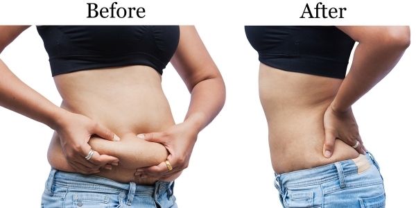 before and after weight loss example